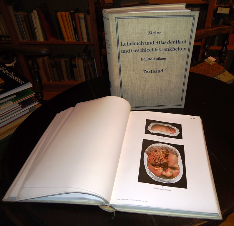 Lehrbuch und Atlas der Haut- und Geschlechtskrankheiten in 2 Bänden. Komplett. 5., vermehrte und verbess. Auflage.